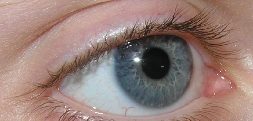 بیماری آب سیاه از زبان یک متخصص چشم بیماری آب سیاه از زبان یک متخصص چشم