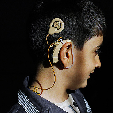 آغاز ثبت نام کاشت حلزون شنوایی آغاز ثبت نام کاشت حلزون شنوایی