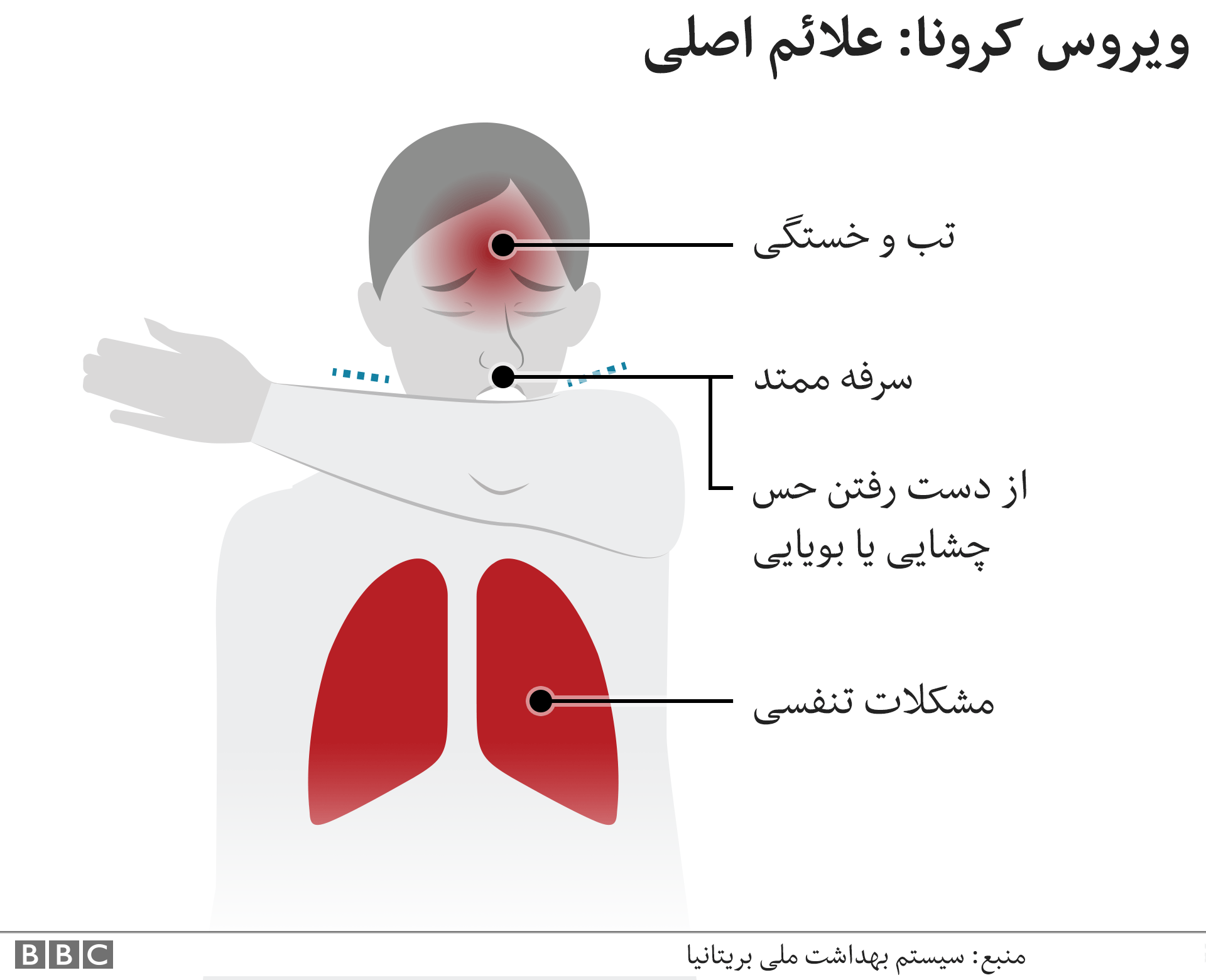 چه سرفه‌ای نشانه کرونا ست؟