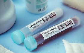 ابتلای 290 نفر به کرونا در آذربایجانغربی در 24 ساعت گذشته